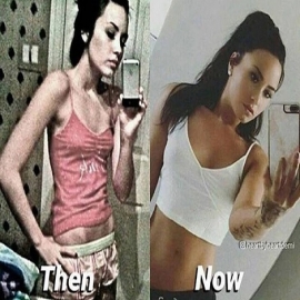 La impactante foto que Demi Lovato compartió con su antes y después de sufrir trastornos alimenticios