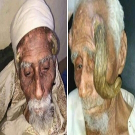 MUERE ALÍ ANTER, EL HOMBRE MÁS VIEJO DEL MUNDO, TRAS CIRUGÍA PARA QUITARLE LOS CUERNOS