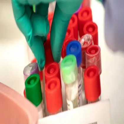 Los anticuerpos contra el COVID duran más de un año después de la infección, encuentra un nuevo estudio finlandés