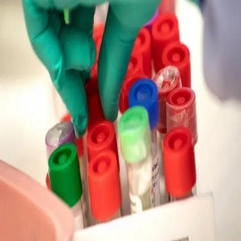 Los anticuerpos contra el COVID duran más de un año después de la infección, encuentra un nuevo estudio finlandés