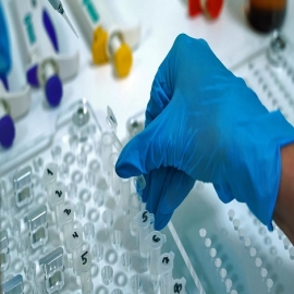Científicos rusos desarrollan un remedio para los coágulos sanguíneos a partir de residuos de madera