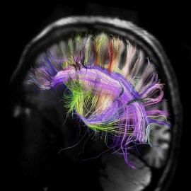 La UE invierte 2.000 millones en el grafeno y la recreación del cerebro humano