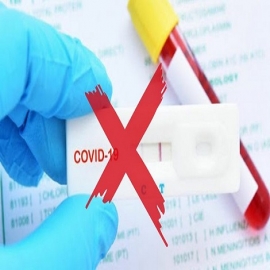 OMS no recomienda usar pruebas masivas para detectar Covid-19 en México